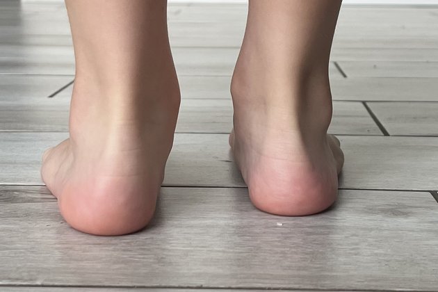 Flexible flat feet standing 1